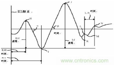 心髒衝擊掃描圖波形